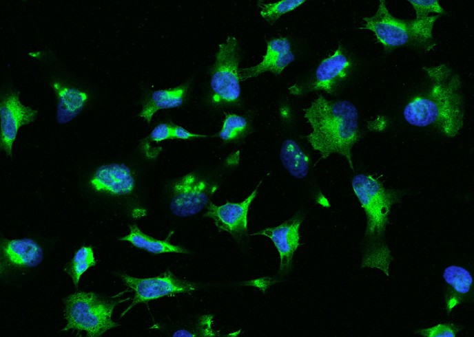 Recombinant RhoA Monoclonal Antibody-searchlist-1