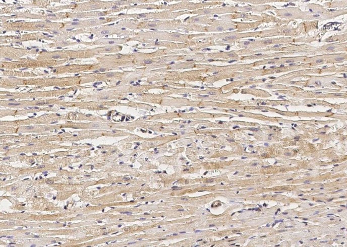 Recombinant DSC2 Monoclonal Antibody-searchlist-1