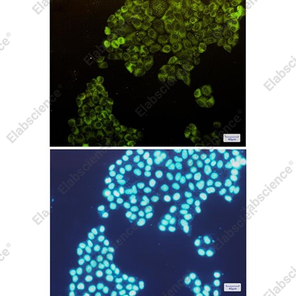 Recombinant Fructose 6 Phosphate Kinase Monoclonal Antibody - 2