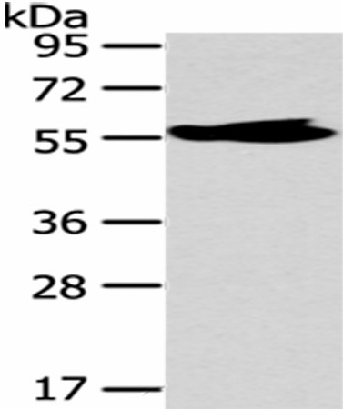 Western Blot analysis of Human fetal brain tissue using MPP6 Polyclonal Antibody at dilution of 1/250