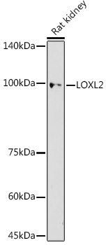 Western blot analysis of extracts of Rat kidney using LOXL2 Polyclonal Antibody at 1:500 dilution.