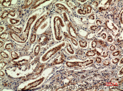 Immunohistochemistry of paraffin-embedded Human kidney tissue using IDH1 Polyclonal Antibody at dilution of 1:100.