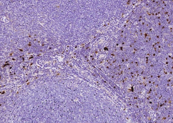 Recombinant S100B Monoclonal Antibody - small - 2