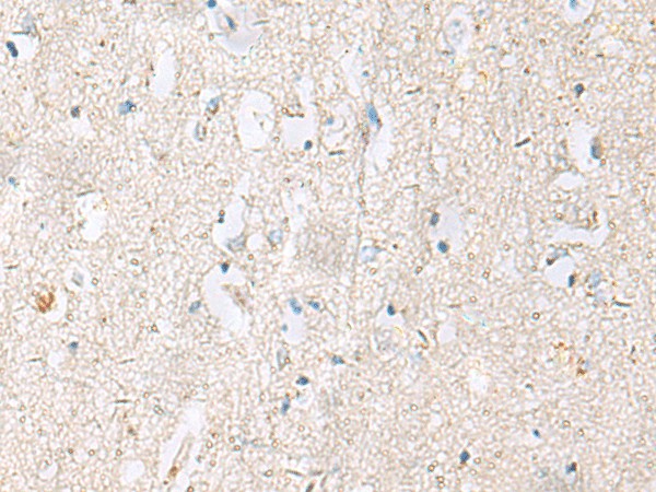 Immunohistochemistry of paraffin-embedded Human brain tissue  using DACT3 Polyclonal Antibody at dilution of 1:55(?200)