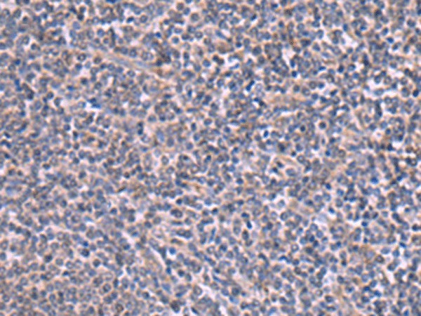 Immunohistochemistry of paraffin-embedded Human tonsil tissue  using RIC3 Polyclonal Antibody at dilution of 1:90(?200)