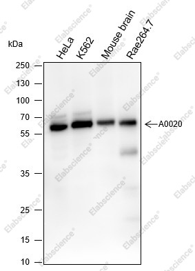 Recombinant ELP3 Monoclonal Antibody - 1