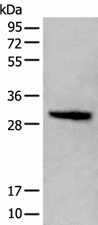 Western blot analysis of Jurkat cell lysate  using HIST1H1C Polyclonal Antibody at dilution of 1:400