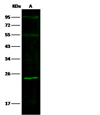 Recombinant SOD2 Monoclonal Antibody - small - 2