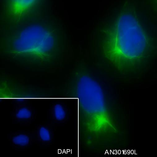 Recombinant Rab11A Monoclonal Antibody - 2