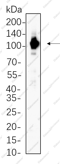 Recombinant STAT6 Monoclonal Antibody - 1