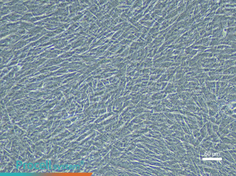 Rabbit Pulmonary Great Artery Smooth Muscle Cell Complete Medium - 4