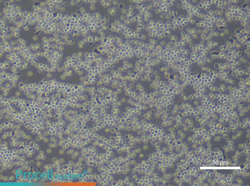 Human Peripheral Blood Mononuclear Cell Complete Medium - 4