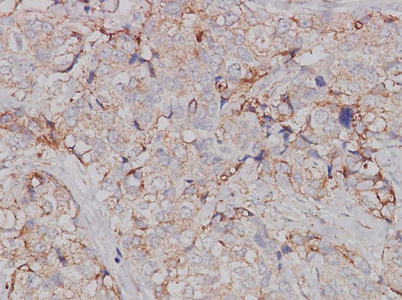 Purified Anti-Human CD194 Antibody[L291H4]-产品推荐-1