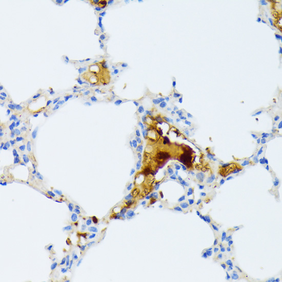 Immunohistochemistry of paraffin-embedded Mouse lung using CTRB1 Polyclonal Antibody at dilution of  1:100 (40x lens).