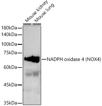 Western blot analysis of extracts of various cell lines using NADPH oxidase 4 Polyclonal Antibody at 1:1000 dilution.