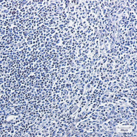 Immunohistochemistry of HMGB1 in paraffin-embedded Human tonsil using HMGB1 Rabbit mAb at dilution 1:100