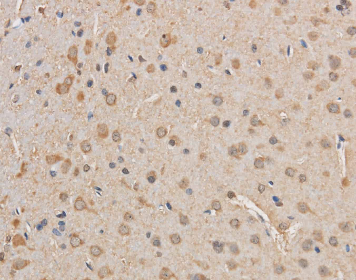 Purified Anti-Mouse/Rat CD29 Antibody[HMβ1-1]-产品推荐-1