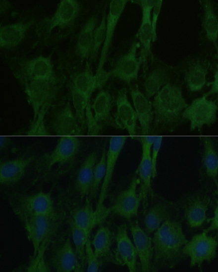 Immunofluorescence analysis of C6 cells using FABP7 Polyclonal Antibody at dilution of 1:100. Blue: DAPI for nuclear staining.