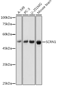 Western blot analysis of extracts of various cell lines using SCRN1 Polyclonal Antibody at 1:1000 dilution.