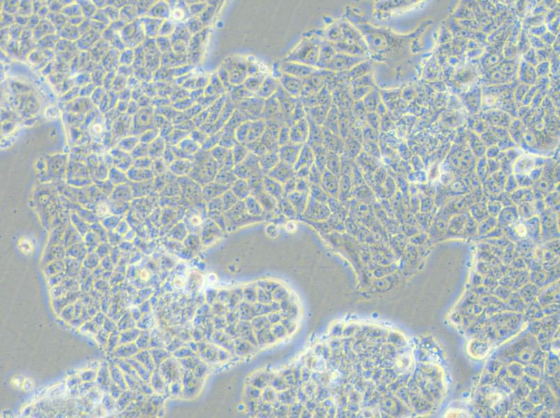 MCF-7-FLUC Cell Complete Medium - 6