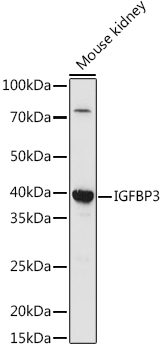 Western blot analysis of extracts of various cell lines using IGFBP3 Polyclonal Antibody at 1:1000 dilution.