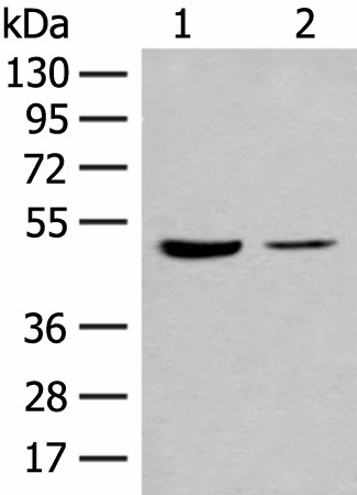 Western blot analysis of Human fetal brain tissue and Jurkat cell lysates  using IL7R Polyclonal Antibody at dilution of 1:500