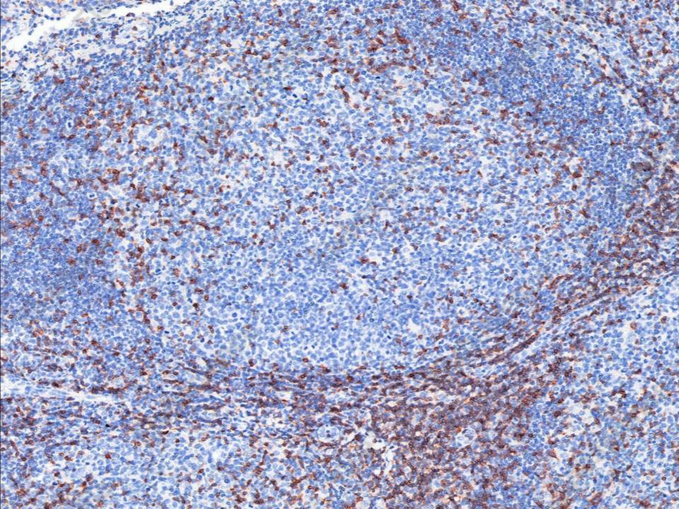 Recombinant CD5/Cluster of Differentiation 5 Monoclonal Antibody - 1