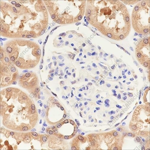Recombinant PPM1A Monoclonal Antibody - 3