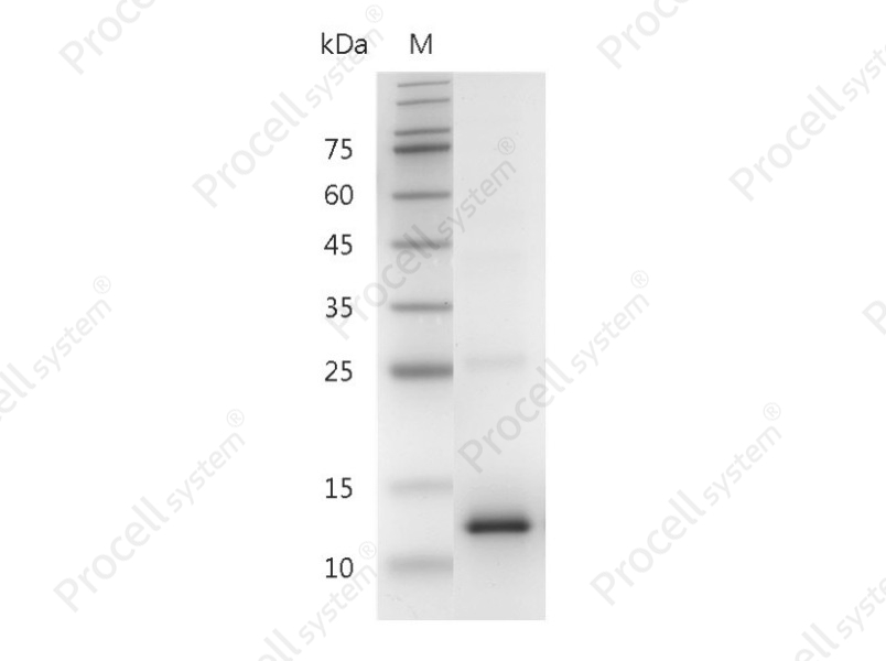 CCL2/MCP-1, Human, Recombinant