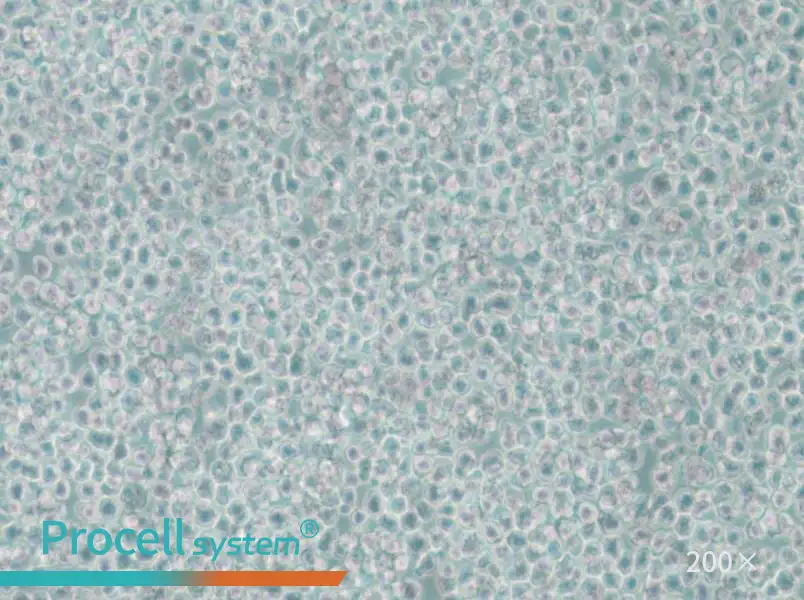 SKNO-1 Cell Complete Medium - 5