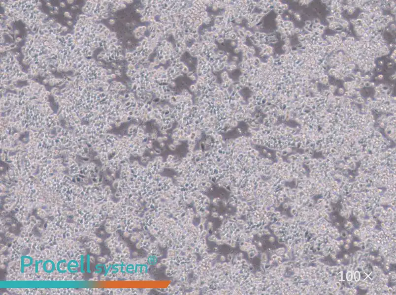 Hce-8693 Cell Complete MediumHce-8693 Cell Complete Medium - 2