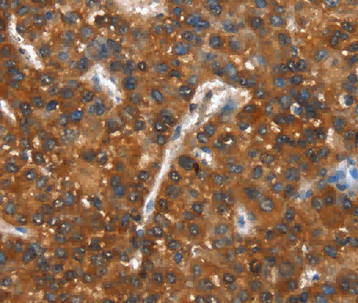 CTBP1 Polyclonal Antibody - 2