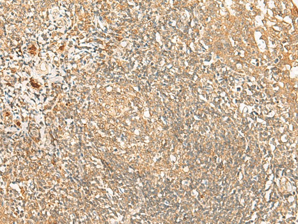 Immunohistochemistry of paraffin-embedded Human tonsil tissue  using PROKR1 Polyclonal Antibody at dilution of 1:40(?200)