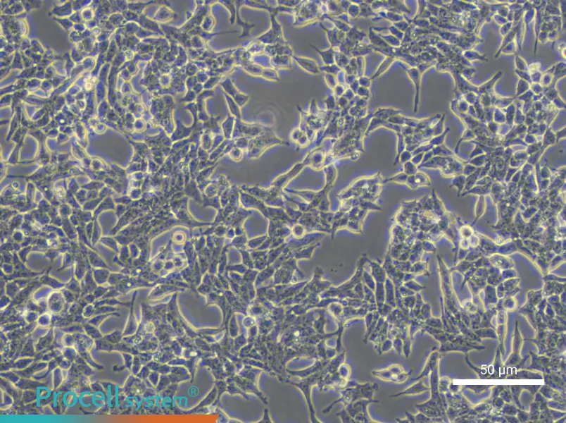 22RV1 Cell Complete Medium - small - 6