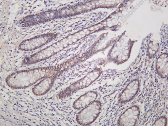 Recombinant GRHL2 Monoclonal Antibody - 1