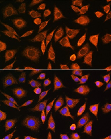 Immunofluorescence analysis of L929 cells using CNOT1 Polyclonal Antibody at dilution of 1:100. Blue: DAPI for nuclear staining.