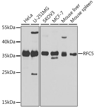 Western blot analysis of extracts of various cell lines using RFC5 Polyclonal Antibody at 1:1000 dilution.