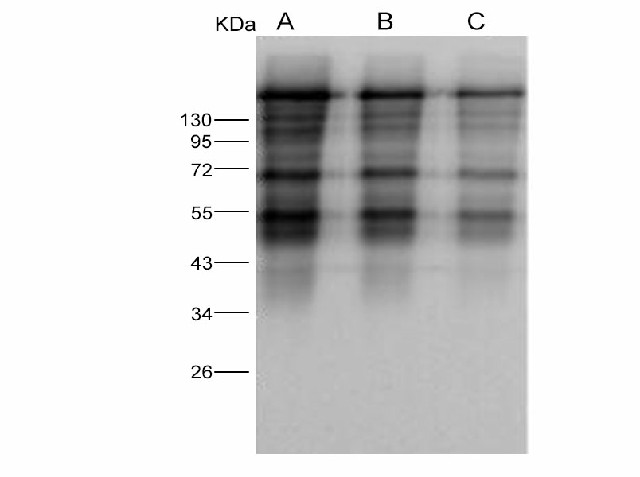 Western Blot analysis of Recombinant MERS-CoV Spike Protein (S1+S2 ECD, aa 1-1297, His Tag)(PKSV030236 with 5ng, 2ng and 1ng ) using Anti-MERS-CoV Spike Polyclonal Antibody at dilution of 1:1000.