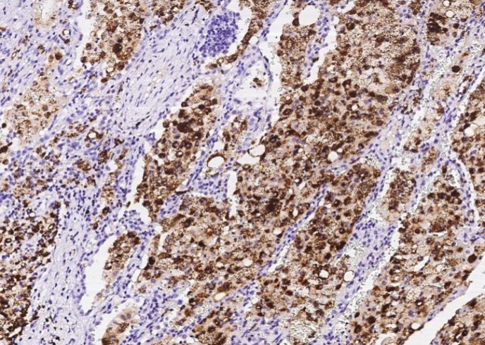 Recombinant FABP4/ALBP/A-FABP Monoclonal Antibody - small - 2