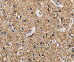 PIP4K2A Polyclonal Antibody - 3