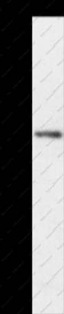 TRAFD1 Polyclonal Antibody - 1