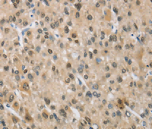 NAPSA Polyclonal Antibody - 2