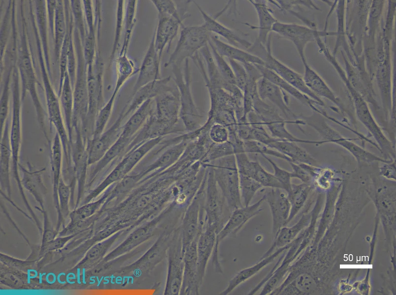 Human Colonic Fibroblast Complete Medium - 4
