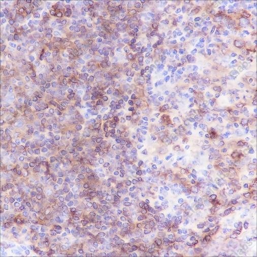 Recombinant HLA-DPB1 Monoclonal Antibody - 2
