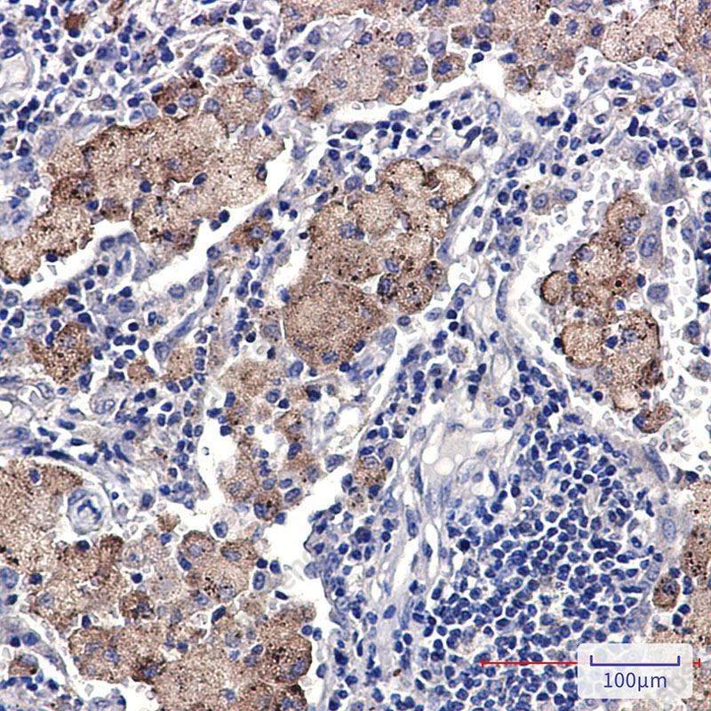 Recombinant Gemin 1 Monoclonal Antibody - 2