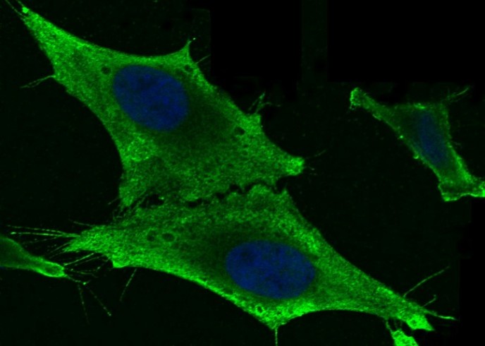 Recombinant GSTM2 Monoclonal Antibody - small - 1