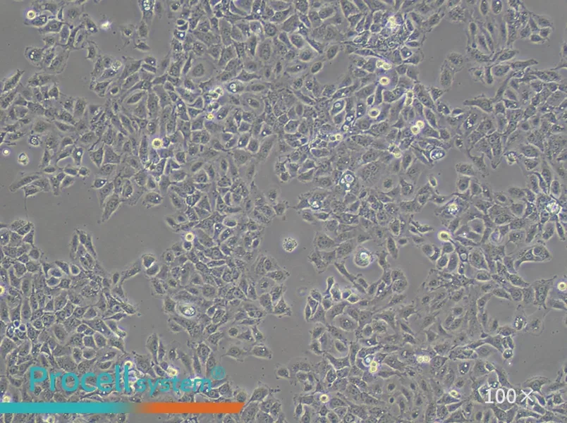 NCI-H292 Cell Complete Medium - 1