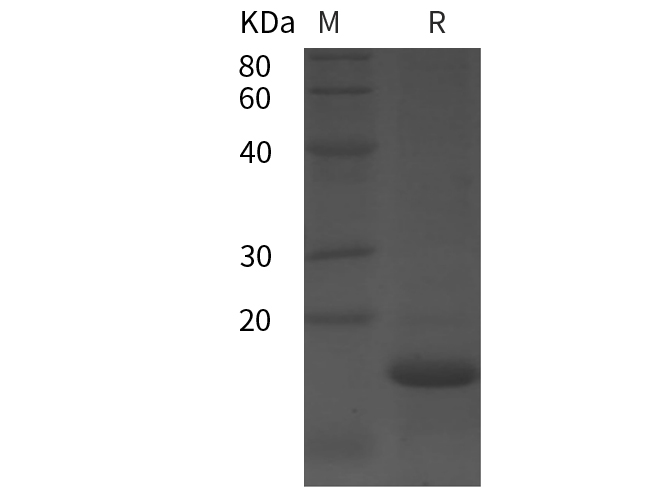 Recombinant Rat IL-4 Protein-产品推荐-8