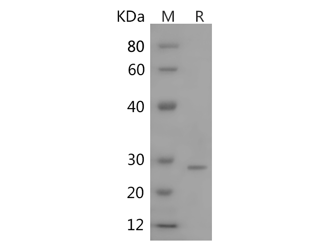 Recombinant Rat IL-1b Protein(Trx Tag)-产品推荐-1