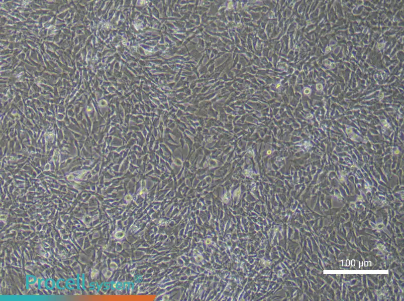 Mouse Bone Marrow Mesenchymal Stem (Primary cell immortalization) Cell Complete Medium - 2